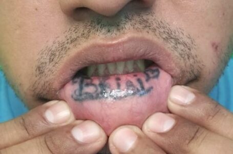 Capturan a pandillero que modificó tatuaje en labio para evadir la justicia