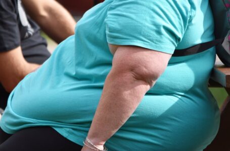 En 2035 la mayoría de la población mundial padecerá de obesidad